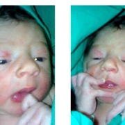 Matteo - 13 novembre 2012, ore 3.20<br />Alla nascita 2,655 kg<br />Ospedale Mangiagalli di Milano